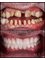 Side Dental Centre - eski hisar mah. demokrasi bulv. 9501 sok . no1 /11 manavgat, whatsapp contact please : +905419521086 && +905060930091, ANTALYA, MANAVGAT, 07600,  19