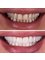 Side Dental Centre - eski hisar mah. demokrasi bulv. 9501 sok . no1 /11 manavgat, whatsapp contact please : +905419521086 && +905060930091, ANTALYA, MANAVGAT, 07600,  28