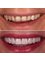 Side Dental Centre - Smile make over 