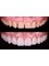 Side Dental Centre - eski hisar mah. demokrasi bulv. 9501 sok . no1 /11 manavgat, whatsapp contact please : +905419521086 && +905060930091, ANTALYA, MANAVGAT, 07600,  18
