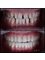 Side Dental Centre - eski hisar mah. demokrasi bulv. 9501 sok . no1 /11 manavgat, whatsapp contact please : +905419521086 && +905060930091, ANTALYA, MANAVGAT, 07600,  31