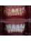 Side Dental Centre - eski hisar mah. demokrasi bulv. 9501 sok . no1 /11 manavgat, whatsapp contact please : +905419521086 && +905060930091, ANTALYA, MANAVGAT, 07600,  32