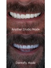 Zirconia Crown - Dentafly Dental Implant and Smile Studio