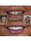 Perla Dental Centre - Smile Makeover 