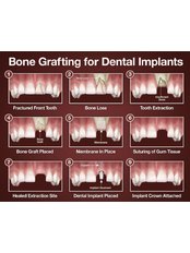 Bone Graft - Perla Dental Centre