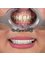 Perla Dental Centre - Smile Makeover  