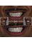 Perla Dental Centre - Zirconium Crowns Smile Makeover 