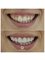 Inter Dental Turkey - Side, Kemer Blv. No.24A, Manavgat, Antalya, 07330,  16