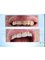 Bulent Kenir Dental Clinic - Turkmen Mahallesi Hulya Kocyigit Bulvari Green Paradise 1 Sitesi, A Blok Daire.2, Aydın, Kusadası, 09400,  7