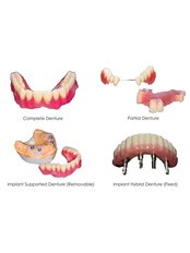 Dentures - Park Dental