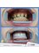 Park Dental - Full Mouth Zirconuim Crowns 