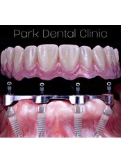 Dental Implants - Park Dental