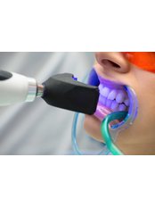 Laser Teeth Whitening - ROYALDENT