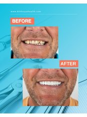 Smile Makeover - 6th House Health