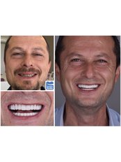 Dentist Consultation - Dental Smile Antalya