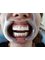 Adnan Menderes Dental - Rumelihisari mah. Nisbetiye cad. Gokmen Apt No: 121/1, istanbul, istanbul, 34000,  8