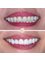 TOWER DENTAL CLINIC - With the power of modern medicine behind us, we offer you a brand new smile! Hollywood Smile gives you a flawless smile similar to that of Hollywood stars. 