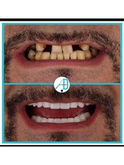 Dentist Consultation - Active Dent