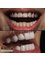 Chiefs Dental - 19 Mayıs Caddesi Dr. Hüsnü İsmet Öztürk Sokak Şişli Plaza, Cevahir Avm Arkası, Istanbul, Şişli, 34250,  6