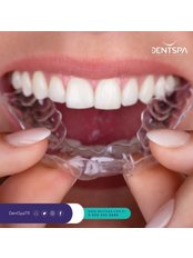 Invisalign™ - DentSpa