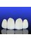 Istanbul Implant and Ecological Dentistry Centre - laminate crowns 