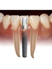Implant - Istanbul Implant and Ecological Dentistry Centre