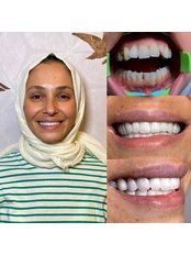 Dentist Consultation - YEG Clinic