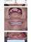 Dr.Dt Tolga Gülçiçek  / Advance Implantology  & Esthetic Dentistry  / Oral and Maxillofacial Surgeon - Atasehir Bulvari 49. ada Kamelya 1 Sitesi 4. blok, Daire 4. 34758 Atasehir / Istanbul, Istanbul, 34758,  21