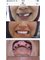 Dr.Dt Tolga Gülçiçek  / Advance Implantology  & Esthetic Dentistry  / Oral and Maxillofacial Surgeon - Atasehir Bulvari 49. ada Kamelya 1 Sitesi 4. blok, Daire 4. 34758 Atasehir / Istanbul, Istanbul, 34758,  22