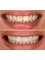 Diş 212 - Dental Aesthetic Facility - Smile design 