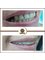 Golden Smile Ağız ve Diş Sağlığı Polikliniği - Dental implants Turkey 