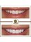 Golden Smile Ağız ve Diş Sağlığı Polikliniği - Cosmetic Dentistry in Turkey 