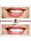Golden Smile Ağız ve Diş Sağlığı Polikliniği - Cosmetic dentist 