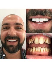 Dentist Consultation - 3B Health Dental Care