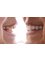 Melan Clinic - Smile Design 
