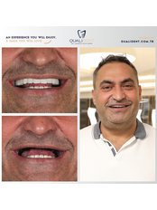 Dental Implants - Qualident