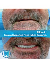 All-on-4 Zahnimplantate - Okutan Zahnkliniken