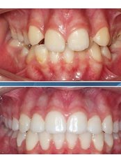 Orthodontics - Temadent Clinics