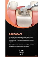 Bone Graft 1cc Straumann Carebone - Mevsim Dental Clinic