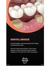 Dental Bridges - Mevsim Dental Clinic