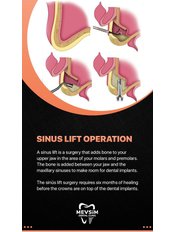Sinus Lift Operation - Mevsim Dental Clinic