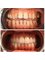 Dr. Yesim Makzume  Aesthetic Dentistry Oral İmplantology Specialist - Implants and veneers smile transformation 