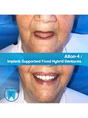 All-on-4 Dental Implants (Zinedent/Straumann Group) (per jaw) - OkutanDis Halkali Dental Clinic