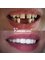 Simsekdent Oral And Dental Health Clinic - Haci Halil Mh. Ataturk Cd. No:53/A, Gebze, Kocaeli, 41400,  6