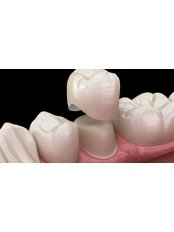 Dental Crowns - MedicalİST