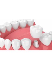 Dental Crowns - Dentapolitan Ümraniye