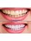 Dentasya Dental Clinic - Namik Kemal Mahallesi̇ Sütçü İmam Caddesi̇ No:70, Dentasya Di̇ş Kli̇ni̇ği̇, Ümraniye, 34764,  2