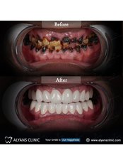 Dentist Consultation - alyans clinic