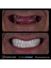 Dentist Consultation - alyans clinic
