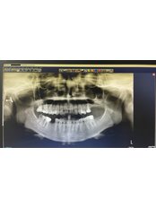 Dentist Consultation - Özel Denteuropa Ağız ve Diş Sağlığı Kliniği